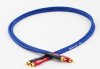 Blue-RCA-Cable-Close-6-Small.jpg
